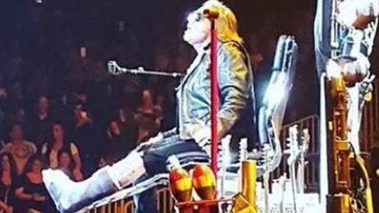 Axl Rose se fracturó un pie en el regreso de los Guns N Roses e inició la gira cantando sentado