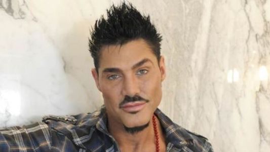 Sin pelos en la lengua / Ricardo Fort mató a las mujeres Maradona