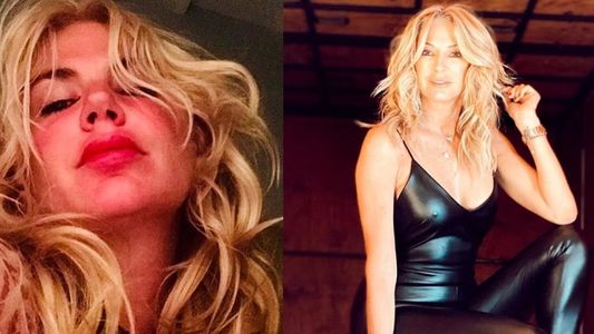 Insólita denuncia a Esmeralda Mitre: se escapó sin pagarle al cirujano plástico