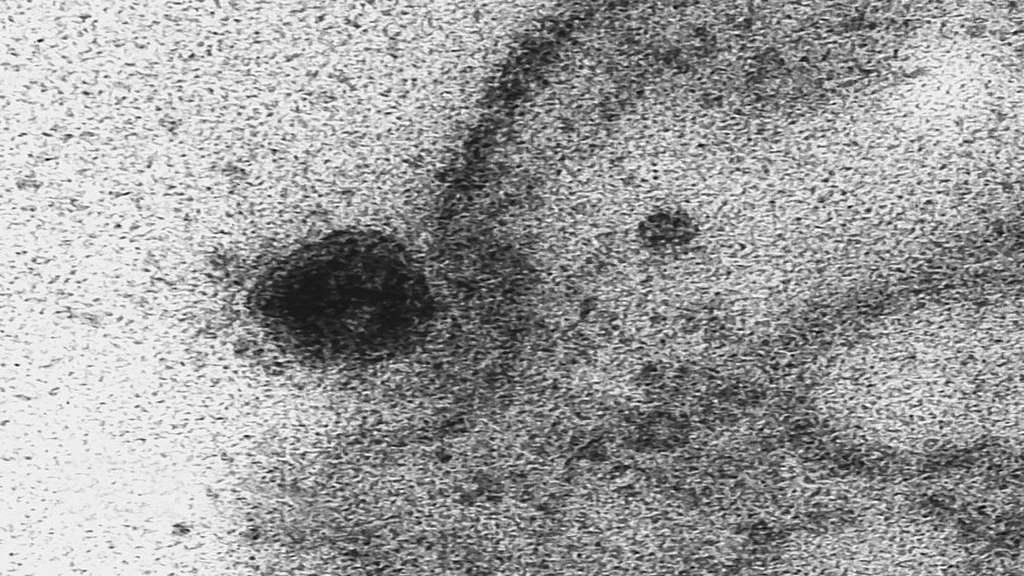 Científicos capturaron el momento exacto en el que el coronavirus infecta una célula
