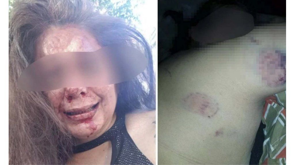 Descubrió que su novio la engañaba, le pidió explicaciones y él le dio una brutal paliza