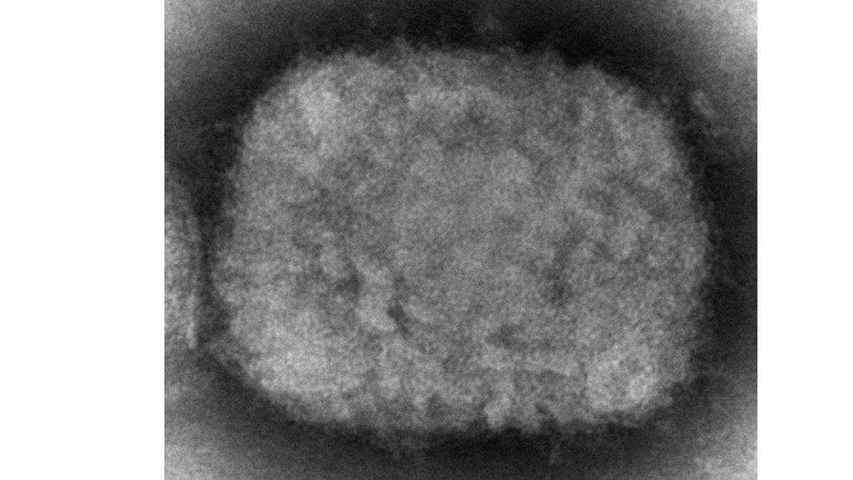 Esta imagen de microscopio de 2003 proporcionada por los Centros para el Control y la Prevención de Enfermedades muestra un virus de la viruela del mono, obtenido de una muestra relacionada con un brote en perros. (Foto: AP)
