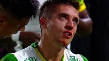 Polémica en Boca-Defensa: Romero le pegó un codazo a Gutiérrez que lo dejó sangrando y el VAR no intervino