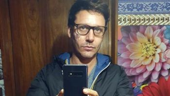 Se supo el origen de la misteriosa cicatriz de Benjamín Vicuña: No se podía mantener de pie