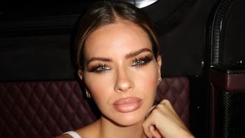 La foto de la China Suárez con dolorosas marcas en el cuerpo que causó impacto