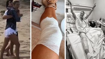 Pía Slapka fue operada tras un accidente: las imágenes