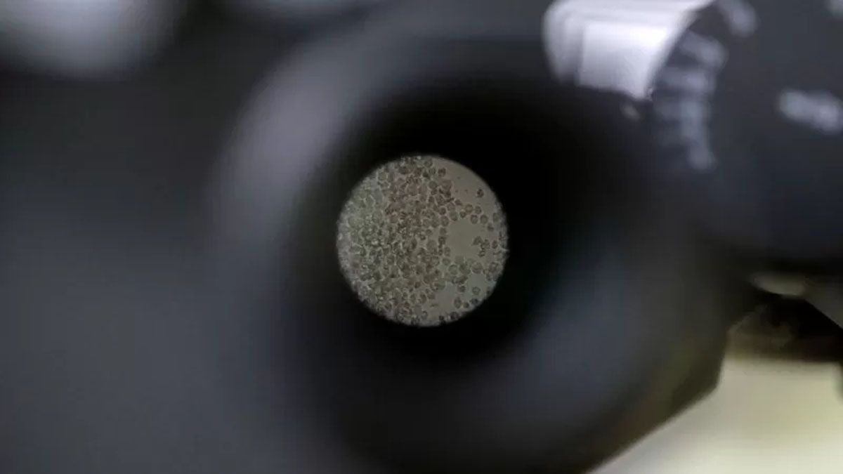 Las Celulas T, que operan como memoria para actuar si regresa un virus al cuerpo humano ( Foto: Archivo)