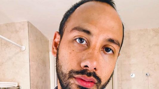 Incendio casi devora vivienda del diseñador Negro Vázquez