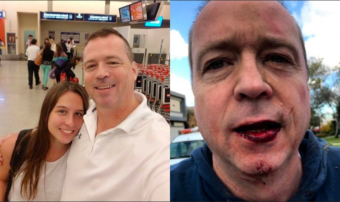 Habló el vecino del Barrio San Marco agredido: Yao Cabrera me podía haber matado