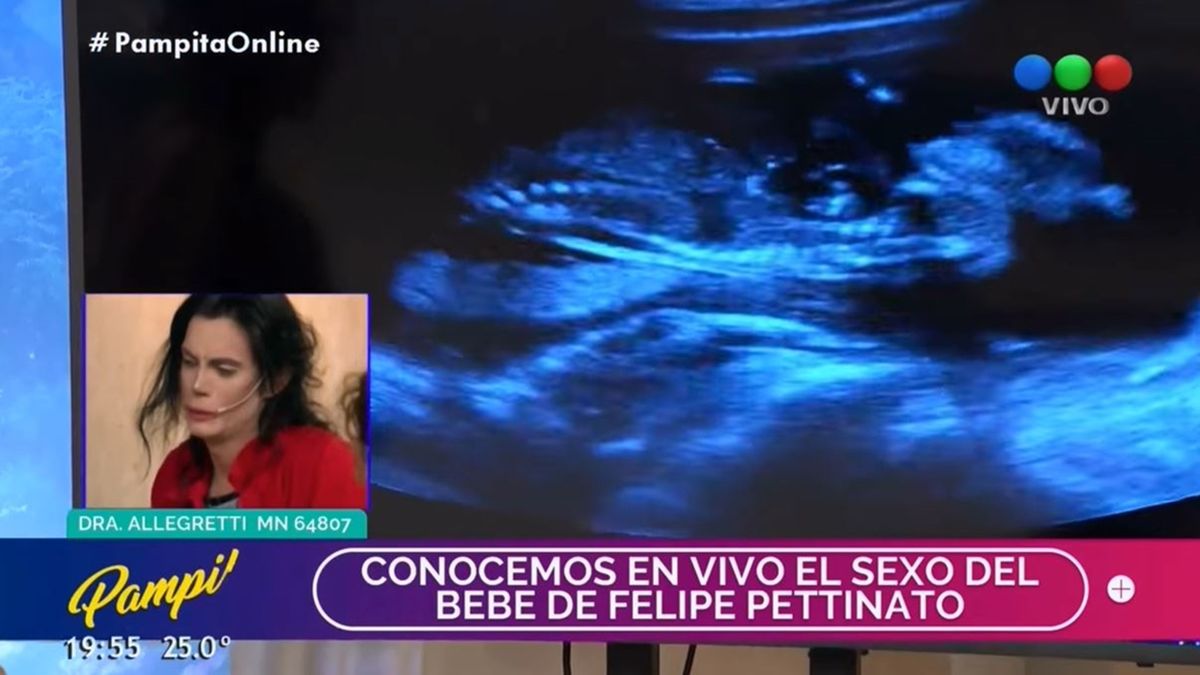 La Ecografía en vivo de la novia de Felipe Pettinato