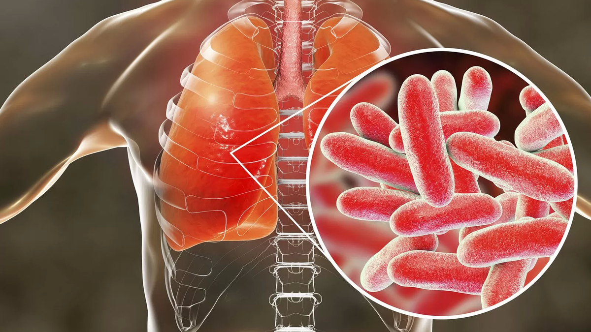 Qué es la legionella