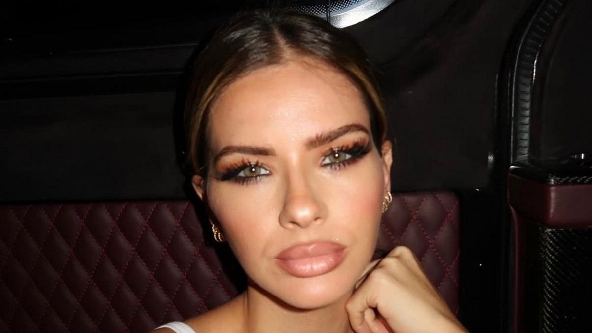 ¿Qué le pasó a La China Suárez? Las fotos desde Turquía con el rostro desfigurado que causaron shock