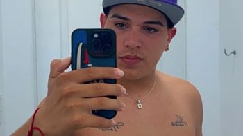 Las impactantes fotos de Thiago Medina de las cicatrices en su cuerpo tras la larga y riesgosa operación