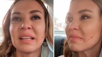 ¿La agresión a Dallys Ferreira fue por celos y engaños?