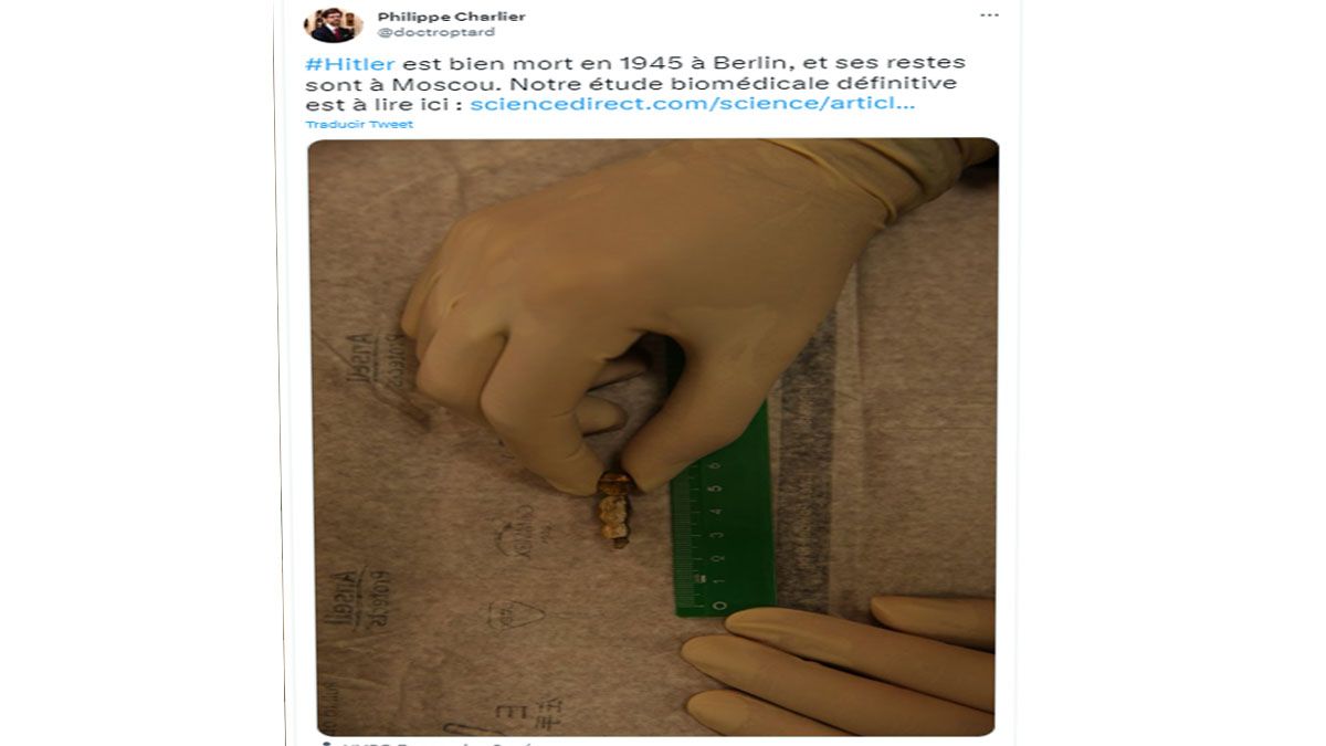 En 2018, un equipo de forenses franceses, dirigido por Philippe Charlier, confirmó que las piezas dentales correspondían al cuerpo de Adolf Hitler (Foto: cuenta de Twitter de Charlier).