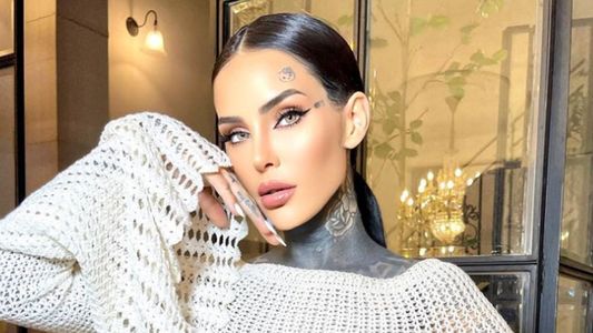 Cande Tinelli fue internada de urgencia en España y mostró las fotos: Ciudado con...
