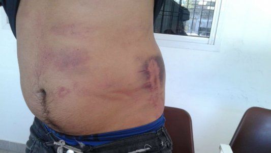 Sobreseyeron a dos guardiacárceles acusados de torturar a un preso porque no hubo testigos