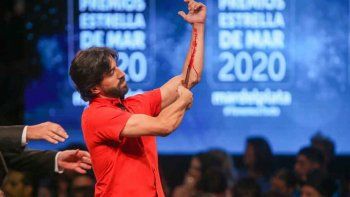 El director Marcos Moyano explicó por qué simuló cortarse las venas