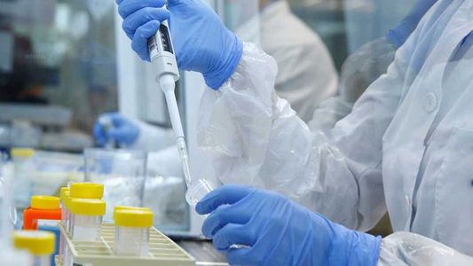 Alerta en Rusia: murió una científica y aislaron a casi 200 personas por una misteriosa infección