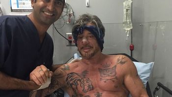 Mickey Rourke se volvió a operar la nariz