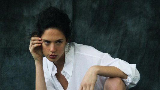 Delfina Chaves reveló el accidente que sufrió de chica ante los comentarios de una cirugía estética