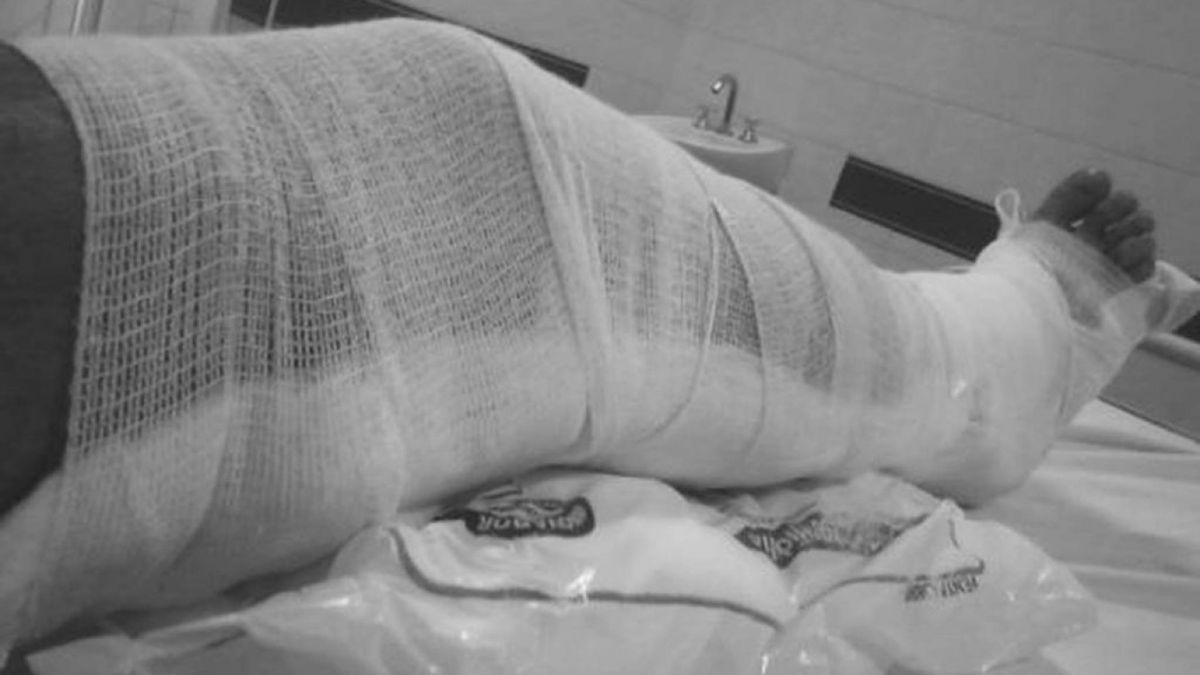 El joven fue entablillado con el cartón de una caja a la que rodearon de papel y gasa