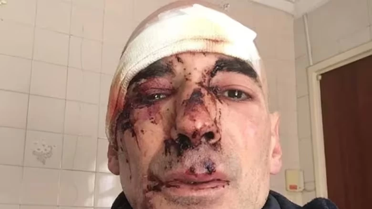 Así quedó el runner agredido. (Foto: NA)