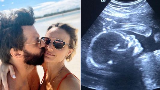 La primera imagen de Capri, la hija del Rifle Varela y Pía Marcollese