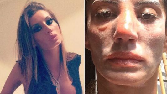 Natacha Jaitt denunció que su ex la golpeó en la calle