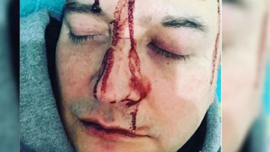 El video de la agresión que sufrió Leo García