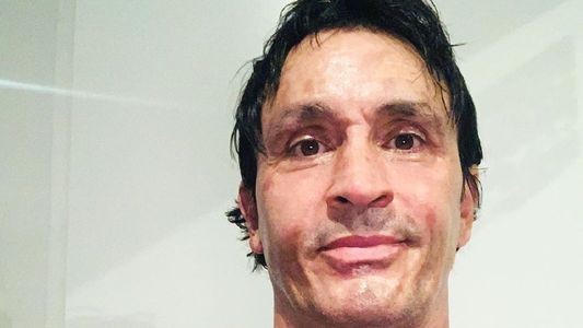 Sebastián Estevanez habló del accidente doméstico que tuvo: Me confié, cometí un error