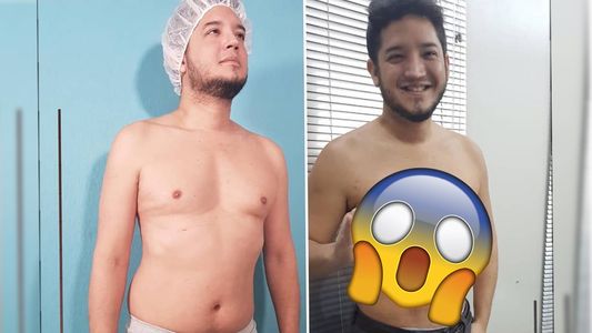 Mirá el antes y el después de la cirugía de Junior