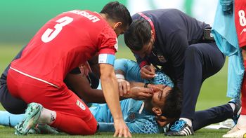 Escalofriante: el arquero de Irán estrelló su cara contra un compañero, derramó sangre y fue reemplazado contra Inglaterra