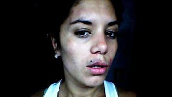 La verdad detrás de las fotos de la ex del Polaco con moretones: de cuándo son y cómo influyen en la causa