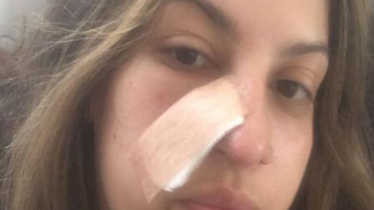 La sorprendente historia de la joven de 27 años que descubrió un cáncer mortal después de una limpieza facial
