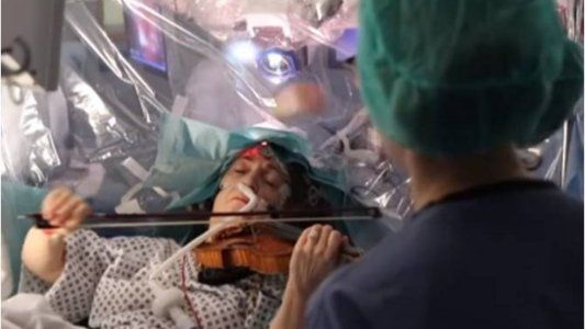La cirugía que asombró al mundo se realiza en la Argentina desde hace ocho años en el Hospital de Clínicas