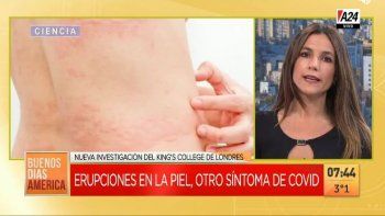 Las erupciones en la piel podrían ser un nuevo síntoma del COVID-19