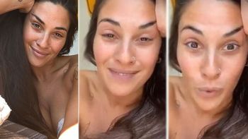 Ivana Nadal volvió a despertar críticas al contar que curó un orzuelo dándole amor”