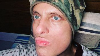 Emotivo mensaje de Lío Pecoraro en su lucha contra la leucemia: Cada vez me falta menos