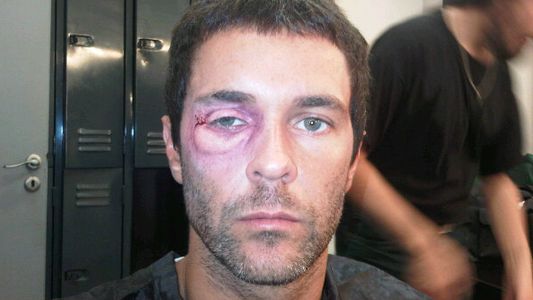 Ojo en compota para Mariano Martínez