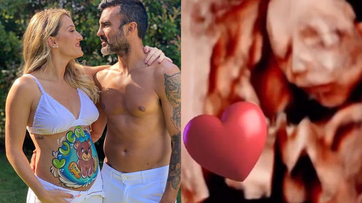 Mica Viciconte compartió una ecografía con la carita de su bebé