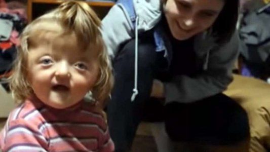 Una guardería le negó la inscripción a una nena rusa porque su cráneo deformado asustaría a otros niños