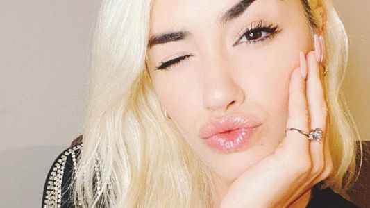 Lali Espósito habló de Ana Paula Rodríguez, que años atrás la acusó de plagio: Pienso que...