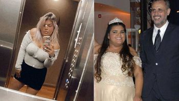 More Rial contó cuánto llegó a pesar antes de someterse a la cirugía de bypass gástrico