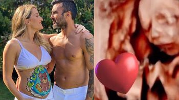 Mica Viciconte compartió una ecografía con la carita de su bebé