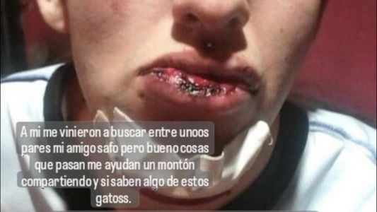 Video: salvaje golpiza a un joven a la salida de un boliche en Ezpeleta