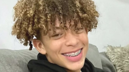 El peligroso desafío de TikTok que dejó a un nene con el 80% del cuerpo quemado