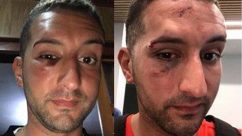 Habló el turista atacado por piqueteros en Misiones