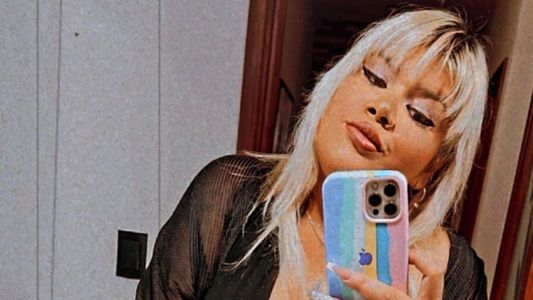 More Rial mostró cómo quedó su cuerpo tras tres cirugías estéticas