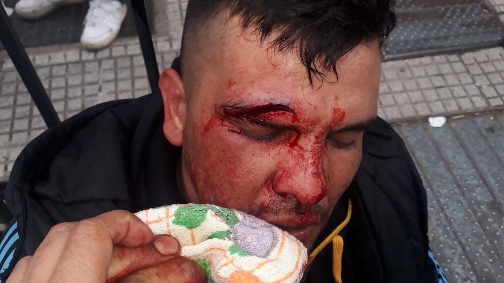 Video: así fue el momento en el cual los manifestantes se enfrentaron con la policía en la 9 de Julio